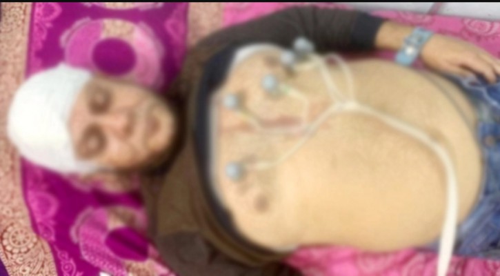 ফেনী পৌর বিএনপির আহ্বায়ককে কুপিয়ে জখম