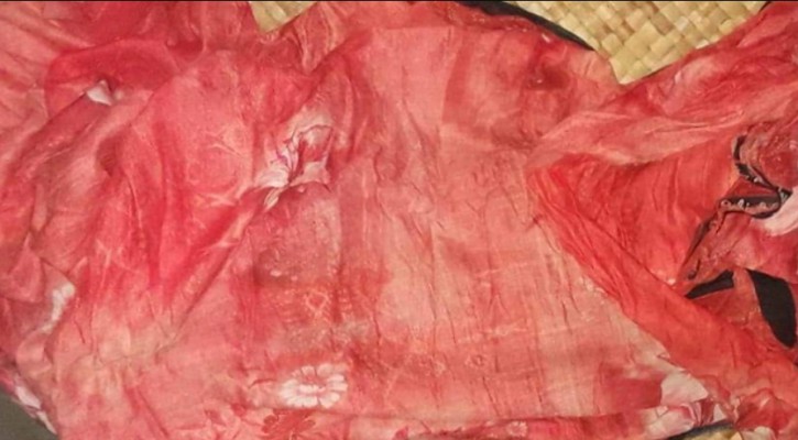 ভোলায় অটোরিকশাচাপায় শিশুর মৃত্যু