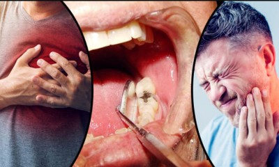 দাঁতের যে সমস্যা হার্ট অ্যাটাকের ইঙ্গিত দেয়