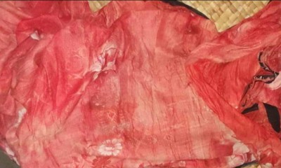 ভোলায় অটোরিকশাচাপায় শিশুর মৃত্যু